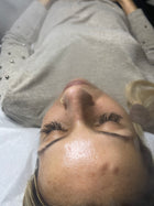 Lemon Honey Facial