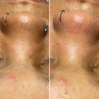 Raspberry Peach Facial